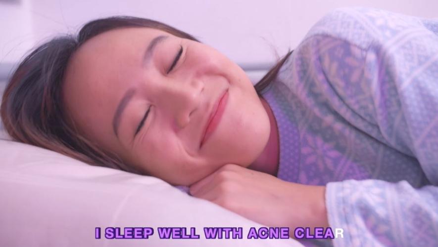 Acne Clear Expert System 